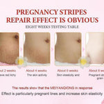 Anti Stretch Mark Cream - RAPBLUE