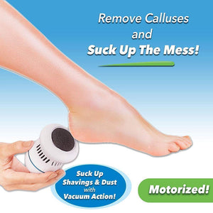 Foot Vac & Callus Remover - RAPBLUE