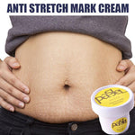 Anti Stretch Mark Cream - RAPBLUE