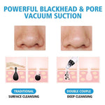 Blackhead Remover Vacuum - Pimple & Acne Suction Tool - RAPBLUE