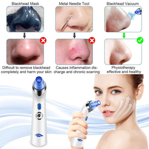 2020 Blackhead Remover Vacuum Tool - RAPBLUE