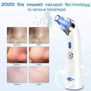 2020 Blackhead Remover Vacuum Tool - RAPBLUE