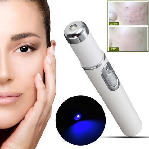 #1 Spider Veins Remover - Medical Blue Light Therapy Laser Treatment Pen - RAPBLUE