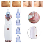 Blackhead Remover Vacuum - Pimple & Acne Suction Tool - RAPBLUE