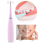 ORALCLEAN™ ULTRASONIC TOOTH CLEANER - RAPBLUE