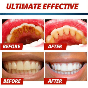 Intensive stain removal whitening toothpaste - RAPBLUE