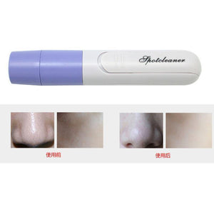 BLACKHEADS VACUUM - RAPBLUE