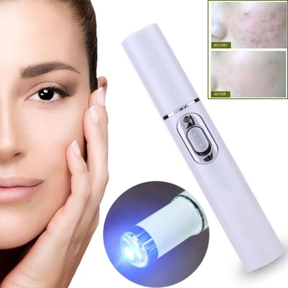 Blue Light Therapy Pen For Acne & Spider Veins - RAPBLUE