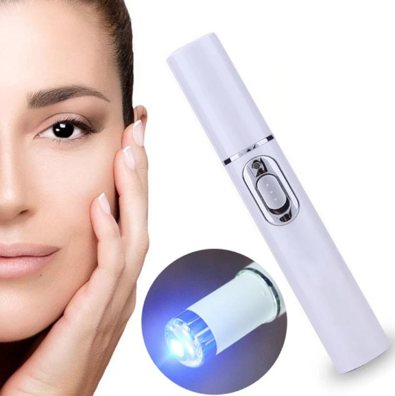 Blue Light Therapy Pen For Acne & Spider Veins - RAPBLUE