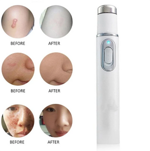 Blue Light Therapy Pen For Acne & Spider Veins - RAPBLUE