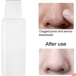 Derma Skin Scrubber Pen - RAPBLUE