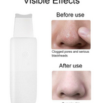 Derma Skin Scrubber Pen - RAPBLUE