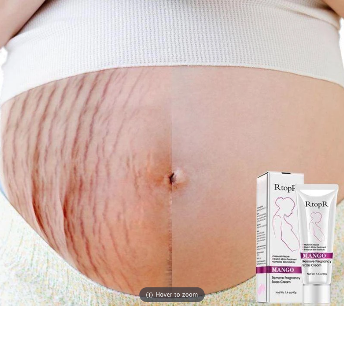 Stretch Mark Cream - RAPBLUE