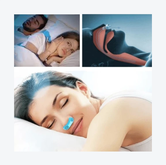 Anti Snoring Device - RAPBLUE