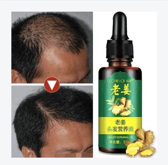 Hair Regrow Oil - Hair Regrowth Serum in 7 Days With Ginger - RAPBLUE