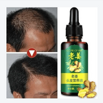 Hair Regrow Oil - Hair Regrowth Serum in 7 Days With Ginger - RAPBLUE
