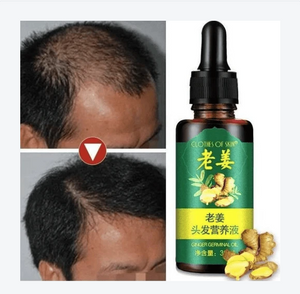 Hair Regrow Oil - Hair Regrowth Serum in 7 Days With Ginger - RAPBLUE