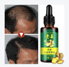 Hair Regrow Oil - Hair Regrowth Serum in 7 Days With Ginger - RAPBLUE