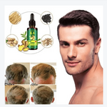 Hair Regrow Oil - Hair Regrowth Serum in 7 Days With Ginger - RAPBLUE