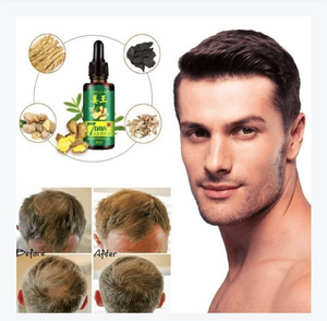 Hair Regrow Oil - Hair Regrowth Serum in 7 Days With Ginger - RAPBLUE