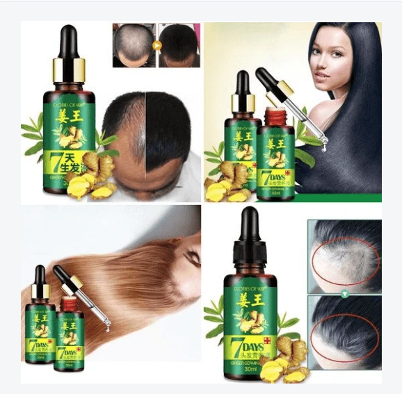 Hair Regrow Oil - Hair Regrowth Serum in 7 Days With Ginger - RAPBLUE