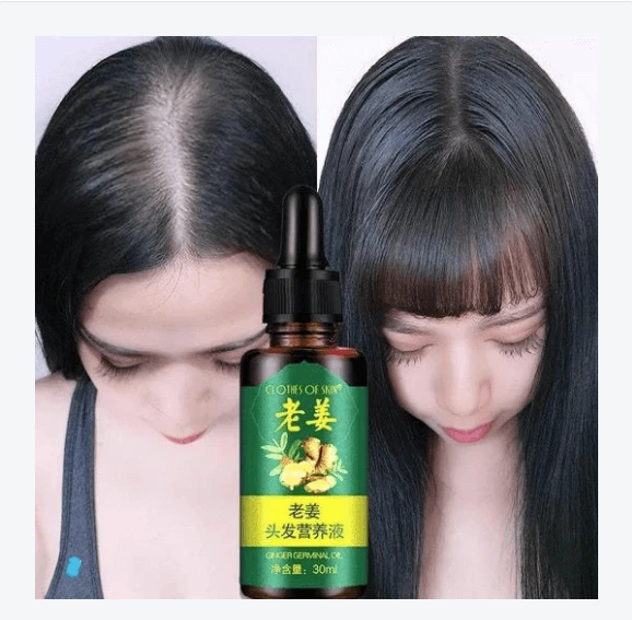 Hair Regrow Oil - Hair Regrowth Serum in 7 Days With Ginger - RAPBLUE