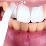 Teeth Whitening Pen - RAPBLUE