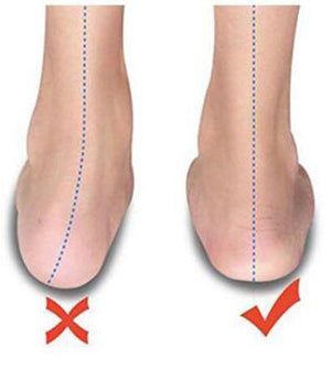 Elastic Bunion Corrector 2.0 - RAPBLUE