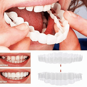 PERFECT SMILE SNAP ON BRACES - RAPBLUE