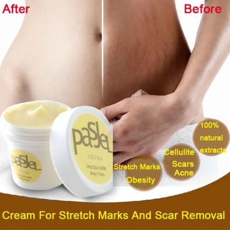 Anti Stretch Mark Cream - RAPBLUE