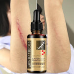 Essential Massage oils Scar Removal - RAPBLUE