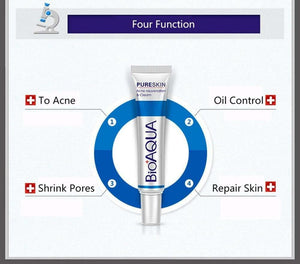 Anti Blackhead Removal Acne Cream - RAPBLUE