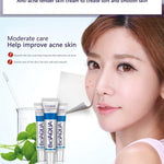 Anti Blackhead Removal Acne Cream - RAPBLUE