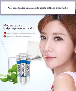 Anti Blackhead Removal Acne Cream - RAPBLUE