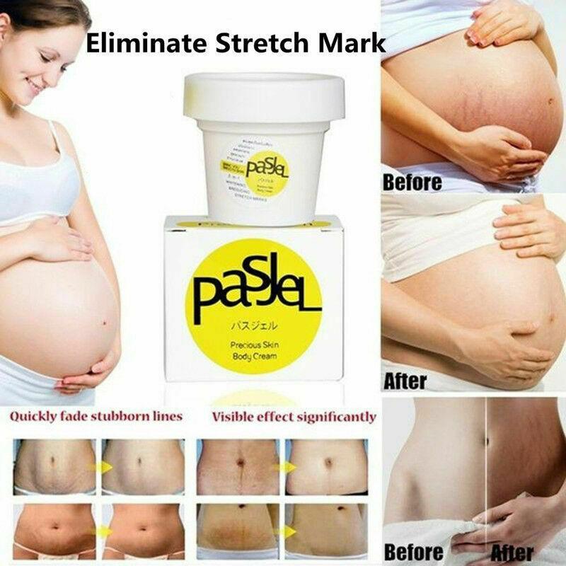 Anti Stretch Mark Cream - RAPBLUE