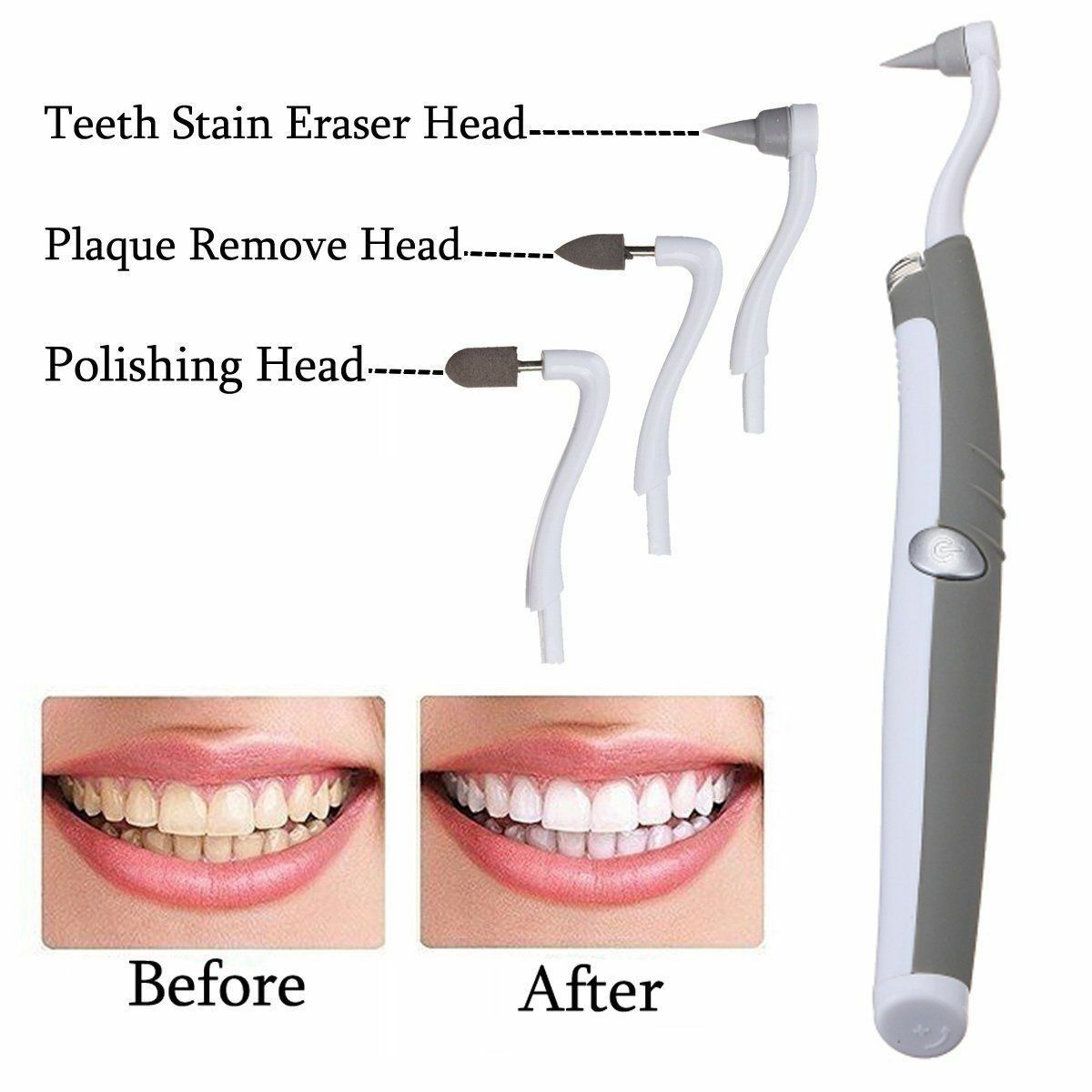 3 in 1 SONIC TOOTH STAIN ERASER WITH PLAQUE REMOVER - RAPBLUE