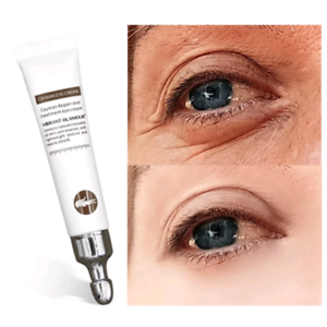 Magic Eye Cream-28 seconds to remove bags under eyes / dark circles / eye wrinkles - RAPBLUE